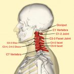 Cervicogenic Headache: Symptoms, Causes, and Treatments