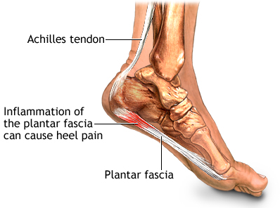 Osteopathy and Plantar Fascitis