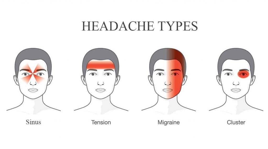 osteopathic treatment of headaches