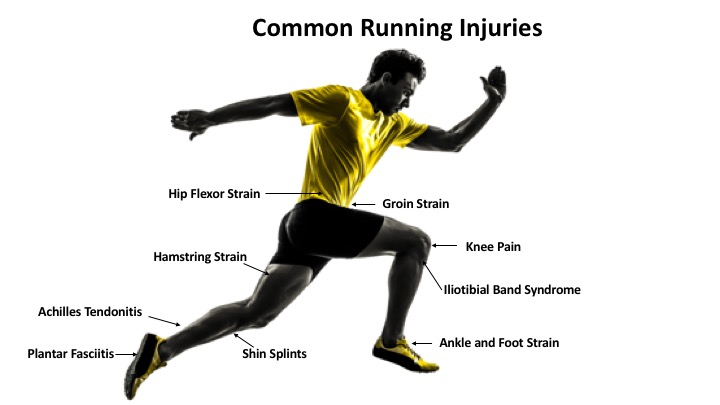 Can osteopathy help with running injuries?