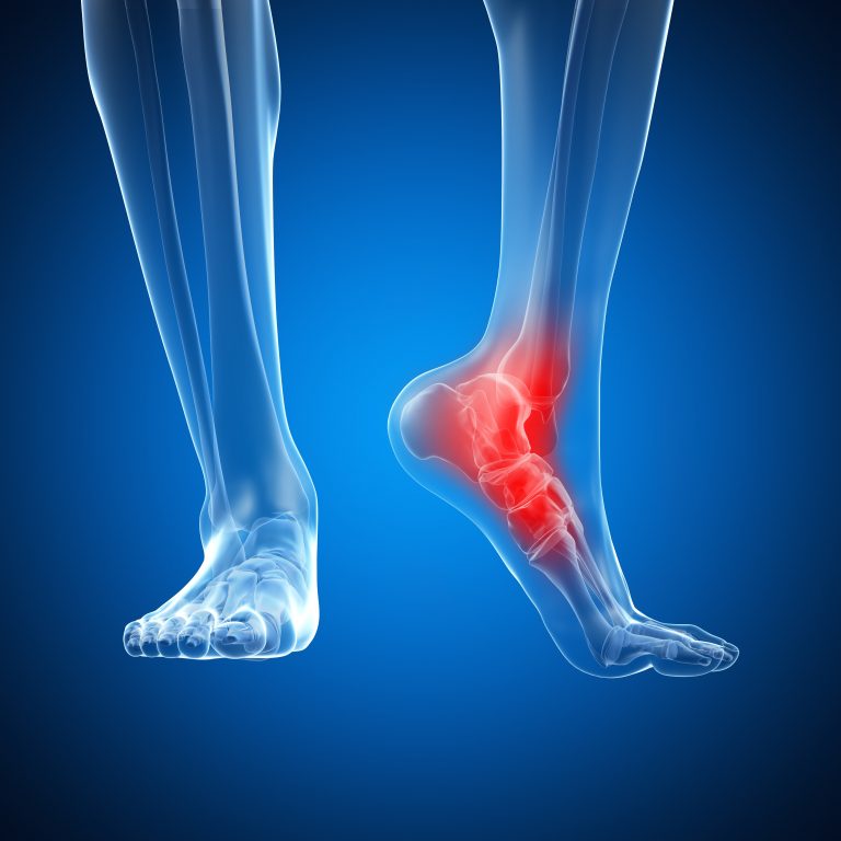 osteopathy for foot and ankle pain
