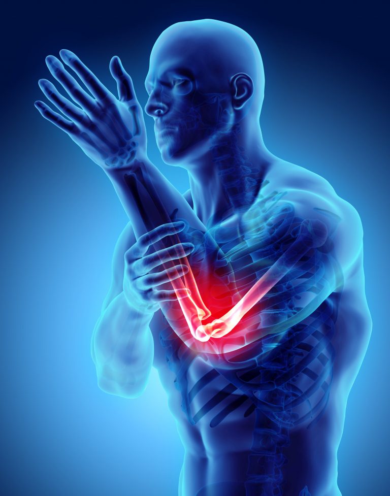 Elbow Pain Osteopathy