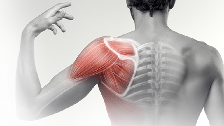 osteopathy for shoulder pain